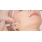 Botox injections for tmj 200iu